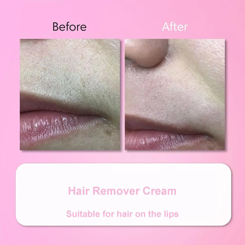 Facial Hair Removal Cream Kit – Gentle & Easy Hair Removal